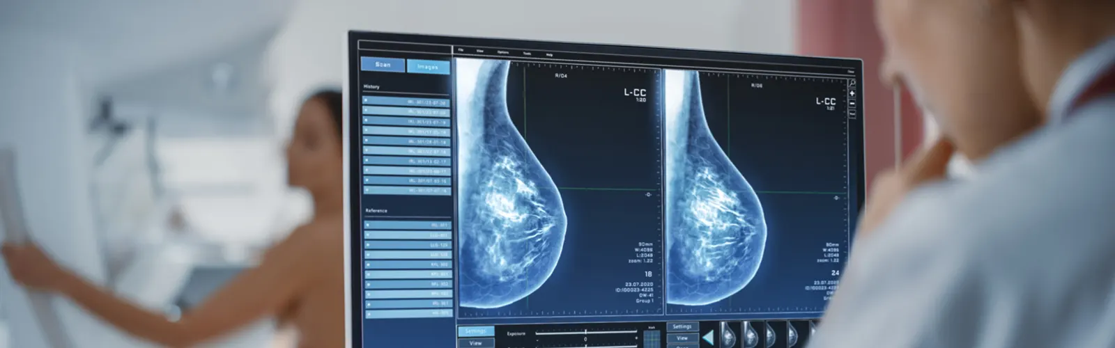 What Are The Different Types Of Mammography?
